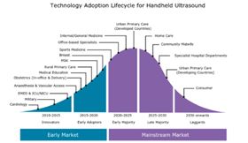 手持超声医疗设备迎来大发展,其原因为何